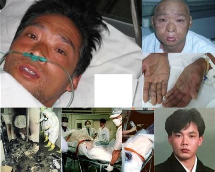 Hisashi Ouchi's Photos Uncover Radiation's Devastating Impact